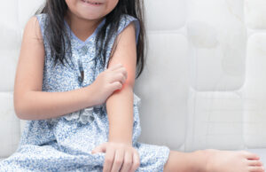 What Causes Atopic Dermatitis in Toddlers scaled