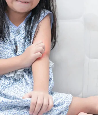 What Causes Atopic Dermatitis in Toddlers scaled