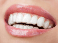 What is Invisalign scaled