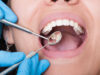 The Economic Impact of Neglected Oral Health